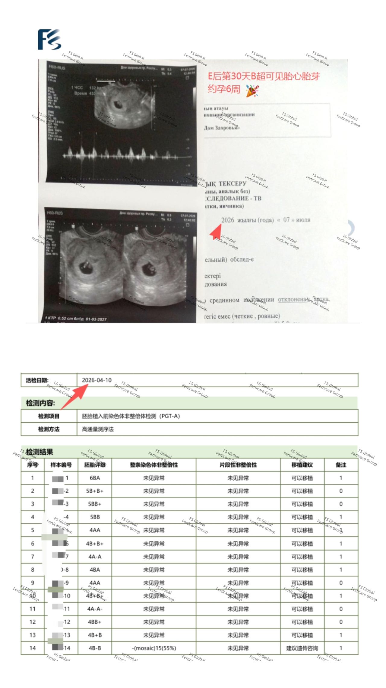 Early-pregnancy record with personal identifiers concealed. 4/4