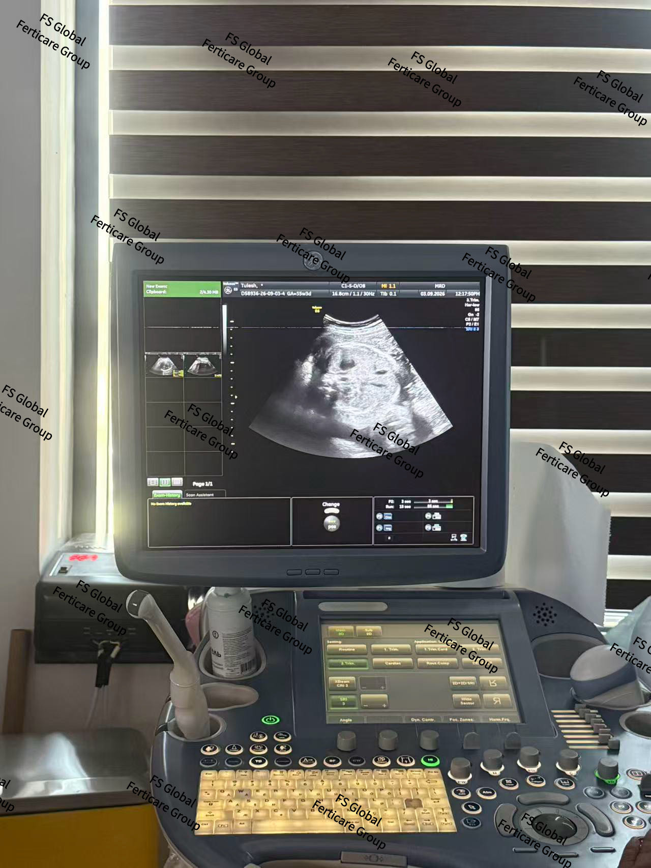 The first participant undergoes an ultrasound examination.