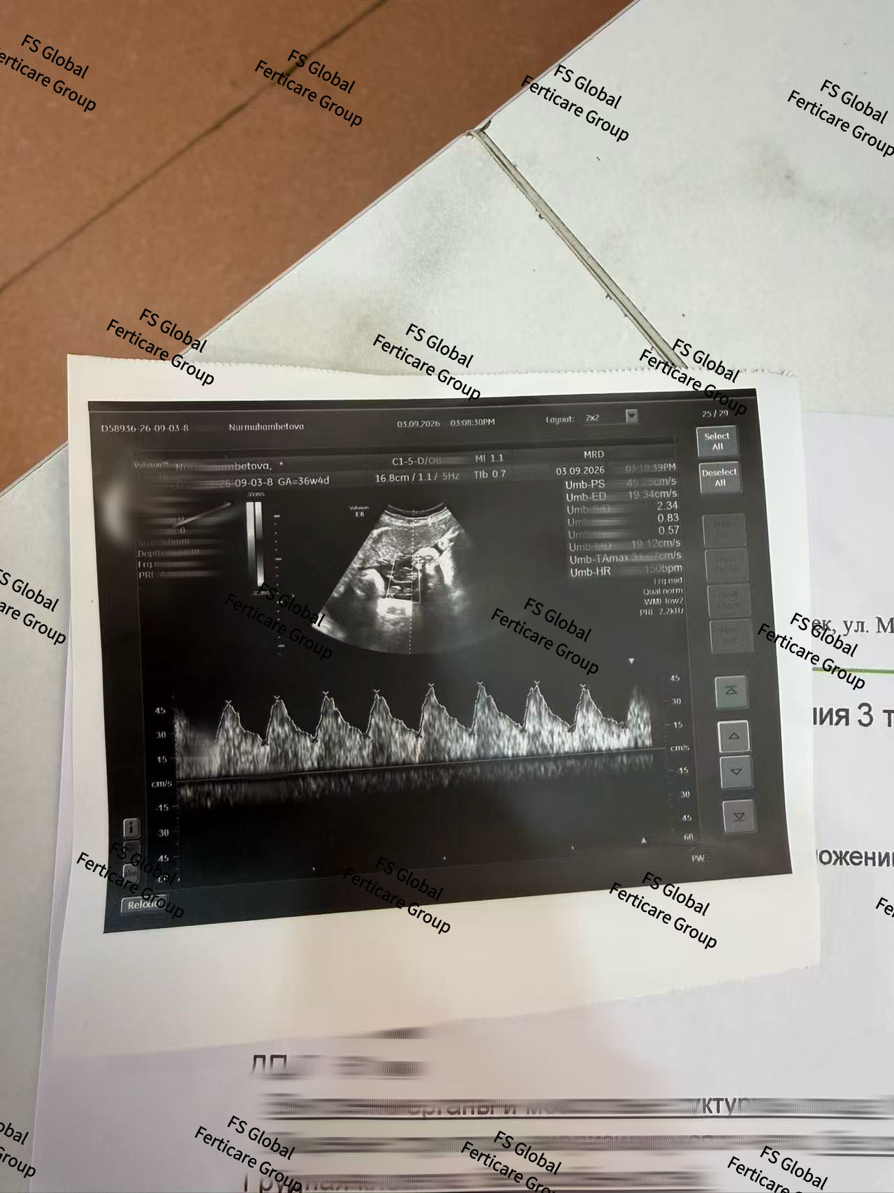 Ultrasound material from the checkup, with personal details handled in the supplied image.