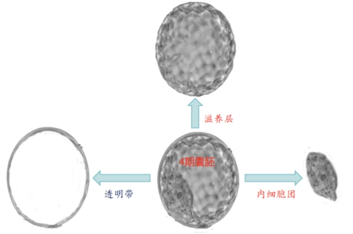囊胚期活检时机对PGT检测质量与妊娠结局的影响